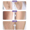 Crystal  Hair Removal